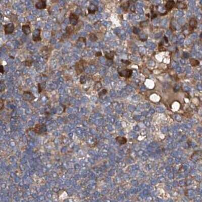 Immunohistochemistry-Paraffin: ASCC3 Antibody [NBP1-88854]
