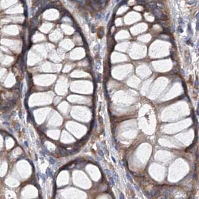 Immunohistochemistry-Paraffin: ASCC3 Antibody [NBP1-88854]