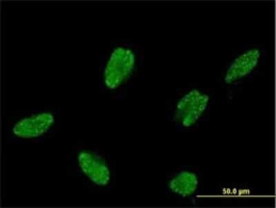 Immunocytochemistry/ Immunofluorescence: ASCL1/Mash1 Antibody (2D9) [H00000429-M02]