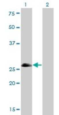 Western Blot: ASCL1/Mash1 Antibody (7E11) [H00000429-M01]