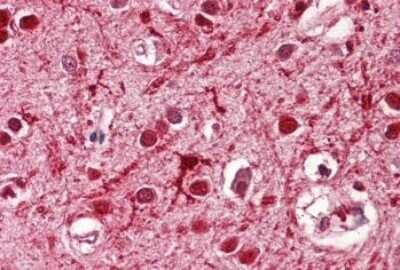 Immunohistochemistry-Paraffin: ASCL3 Antibody [NBP1-68871]