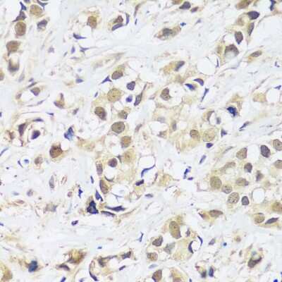 Immunohistochemistry-Paraffin: ASCL4 Antibody - Azide and BSA Free [NBP2-92741]
