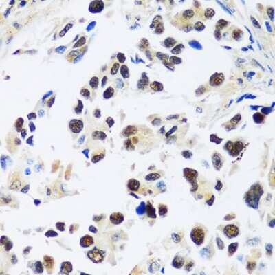 Immunohistochemistry-Paraffin: ASCL4 Antibody - Azide and BSA Free [NBP2-92741]