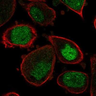 Immunocytochemistry/ Immunofluorescence: ASF1a Antibody [NBP2-57608]