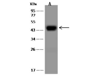 Western Blot: ASGPR1 Antibody (024) [NBP2-89638]