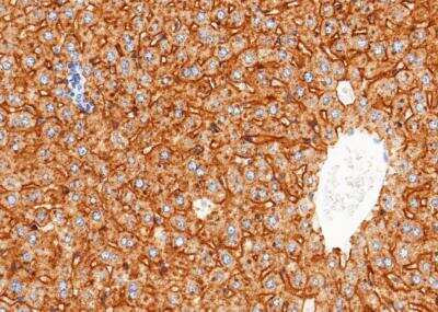 Immunohistochemistry-Paraffin: ASGPR1 Antibody (114) [NBP2-90400]