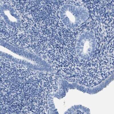 Immunohistochemistry-Paraffin: ASGPR1 Antibody [NBP1-85580]