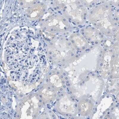 Immunohistochemistry-Paraffin: ASGPR1 Antibody [NBP1-85580]
