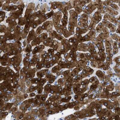 Immunohistochemistry-Paraffin: ASGPR1 Antibody [NBP1-85580]