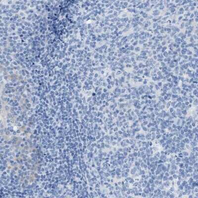 Immunohistochemistry-Paraffin: ASGPR1 Antibody [NBP1-85580]