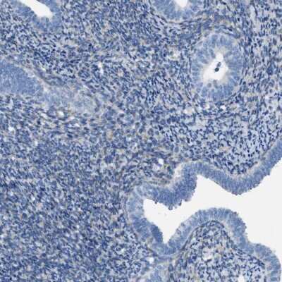Immunohistochemistry-Paraffin: ASGPR1 Antibody [NBP1-85581]