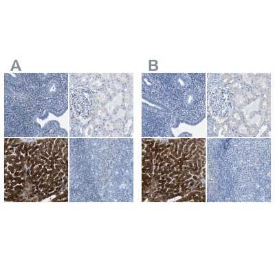 Immunohistochemistry-Paraffin: ASGPR1 Antibody [NBP1-85581]