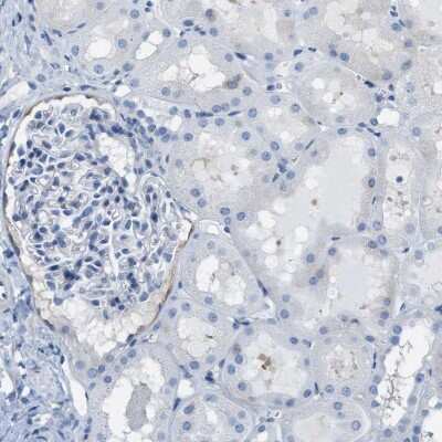 Immunohistochemistry-Paraffin: ASGPR1 Antibody [NBP1-85581]