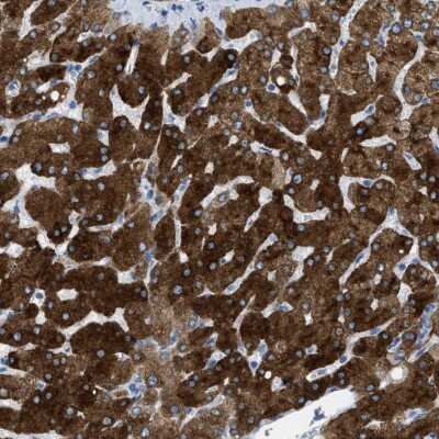Immunohistochemistry-Paraffin: ASGPR1 Antibody [NBP1-85581]