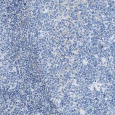 Immunohistochemistry-Paraffin: ASGPR1 Antibody [NBP1-85581]