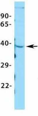 Western Blot: ASGPR1 Antibody [NBP1-54385]