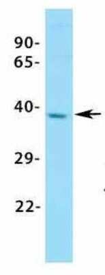 Western Blot: ASGPR1 Antibody [NBP1-54385]