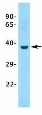 Western Blot: ASGPR1 Antibody [NBP1-54385]