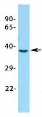 Western Blot: ASGPR1 Antibody [NBP1-54385]