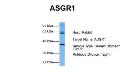 Western Blot: ASGPR1 Antibody [NBP1-54385]
