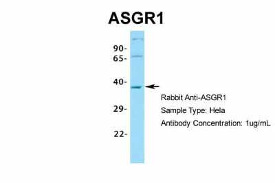 Western Blot: ASGPR1 Antibody [NBP1-54385]