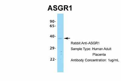 Western Blot: ASGPR1 Antibody [NBP1-54385]