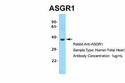 Western Blot: ASGPR1 Antibody [NBP1-54385]