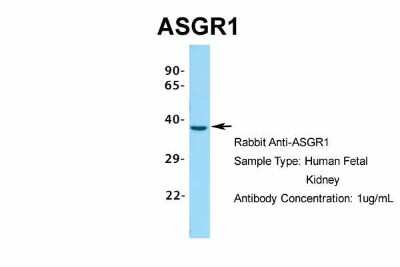 Western Blot: ASGPR1 Antibody [NBP1-54385]