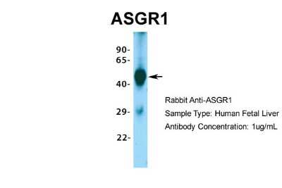Western Blot: ASGPR1 Antibody [NBP1-54385]
