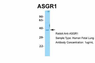 Western Blot: ASGPR1 Antibody [NBP1-54385]