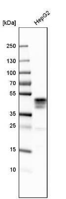 Western Blot: ASGPR1 Antibody [NBP1-85581]