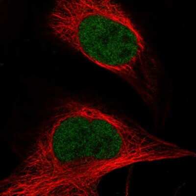 Immunocytochemistry/ Immunofluorescence: ASH2L Antibody [NBP1-88858]