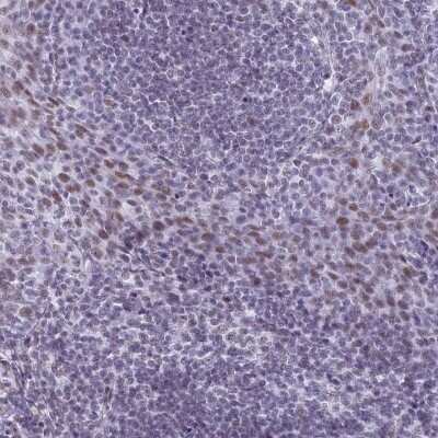 Immunohistochemistry-Paraffin: ASH2L Antibody [NBP1-88858]