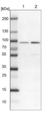 Western Blot: ASH2L Antibody [NBP1-88858]