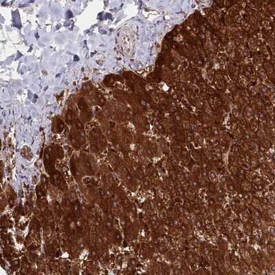 Immunohistochemistry-Paraffin: ASNSD1 Antibody [NBP1-83634]