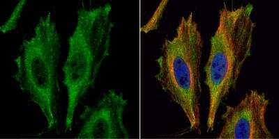Immunocytochemistry/ Immunofluorescence: ASPA Antibody [NBP1-31754]