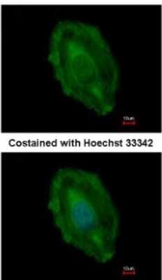 Immunocytochemistry/ Immunofluorescence: ASPA Antibody [NBP2-15491]