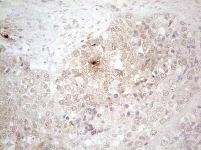 Immunohistochemistry: ASPA Antibody (OTI3G5) - Azide and BSA Free [NBP2-70216]