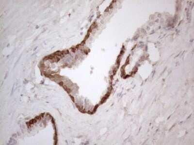 Immunohistochemistry: ASPA Antibody (OTI3G5) - Azide and BSA Free [NBP2-70216]