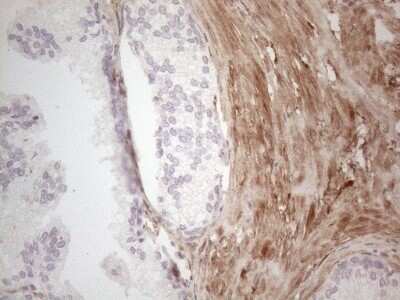 Immunohistochemistry: ASPA Antibody (OTI3G5) - Azide and BSA Free [NBP2-70216]