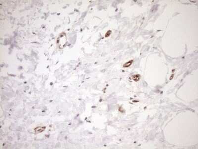 Immunohistochemistry: ASPDH Antibody (OTI4G8) [NBP2-46550]