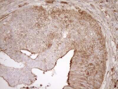 Immunohistochemistry: ASPDH Antibody (OTI4G8) [NBP2-46550]