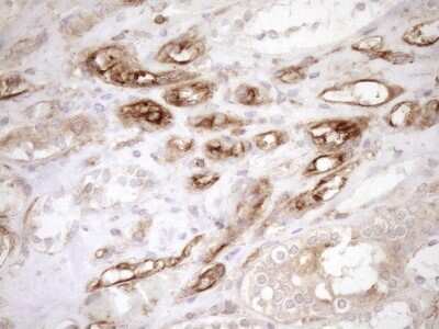 Immunohistochemistry: ASPDH Antibody (OTI4G8) [NBP2-46550]