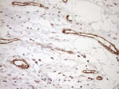 Immunohistochemistry: ASPDH Antibody (OTI4G8) [NBP2-46550]
