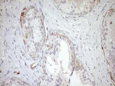 Immunohistochemistry: ASPDH Antibody (OTI4G8) [NBP2-46550]