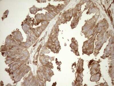 Immunohistochemistry: ASPDH Antibody (OTI4G8) - Azide and BSA Free [NBP2-72508]