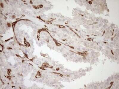 Immunohistochemistry: ASPDH Antibody (OTI4G8) - Azide and BSA Free [NBP2-72508]