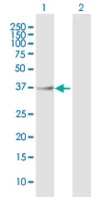 Western Blot: ASPHD1 Antibody [H00253982-B01P]