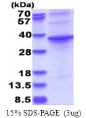 SDS-PAGE: Recombinant Human ASPHD1 His Protein [NBP2-51740]