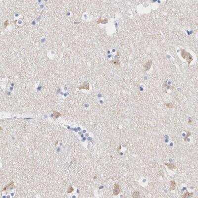 Immunohistochemistry-Paraffin: ASPHD2 Antibody [NBP1-83461]
